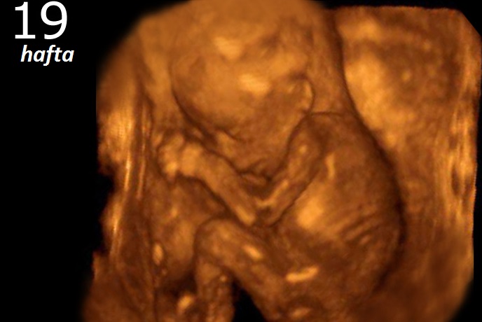 19. hafta bebegin ultrasonda görünüsü