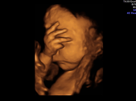 28 haftalik bebek ultrason görüntüsü