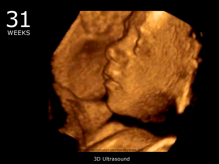 31 haftalik bebek ultrason görüntüsü