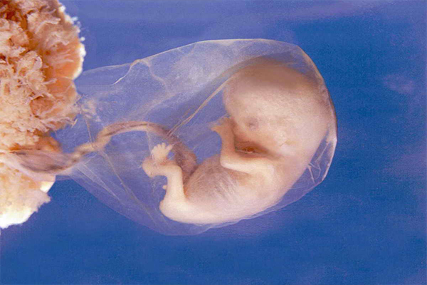 gebelikte 9. hafta fetus görünümü